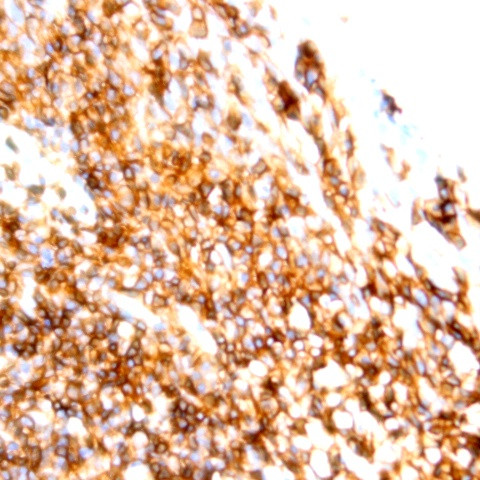 CD45RO Antibody in Immunohistochemistry (Paraffin) (IHC (P))