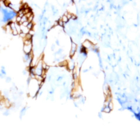 CD64 Antibody in Immunohistochemistry (Paraffin) (IHC (P))