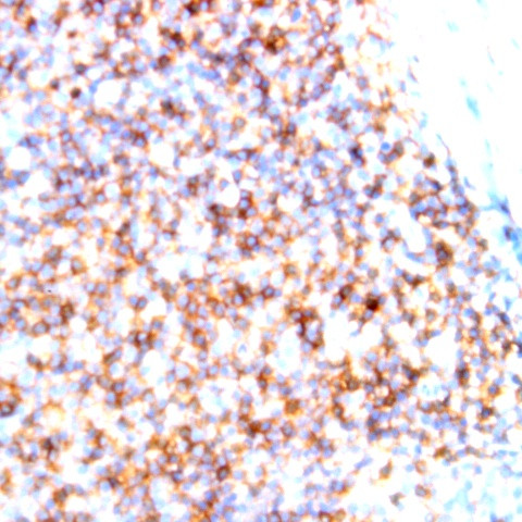 CD66c Antibody in Immunohistochemistry (Paraffin) (IHC (P))