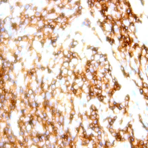 CD9 Antibody in Immunohistochemistry (Paraffin) (IHC (P))