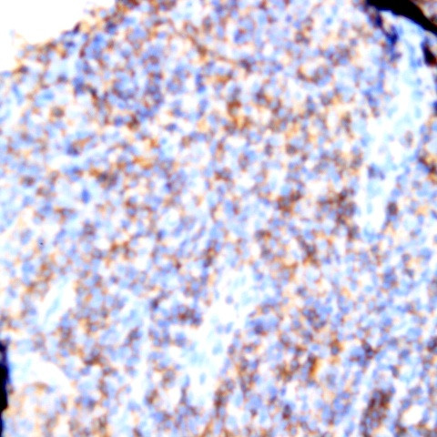 HLA-DR Antibody in Immunohistochemistry (Paraffin) (IHC (P))