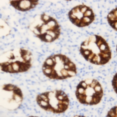 Annexin 7 Antibody in Immunohistochemistry (Paraffin) (IHC (P))