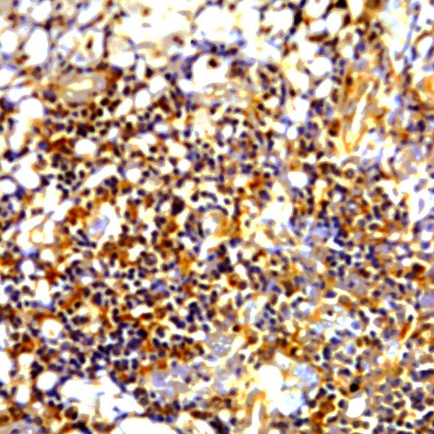 BCL-6 Antibody in Immunohistochemistry (Paraffin) (IHC (P))