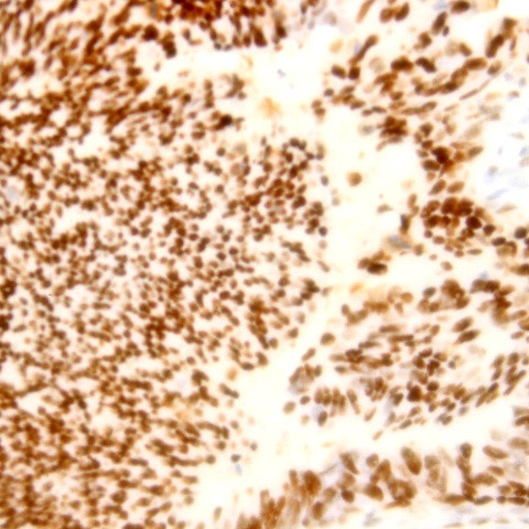 BCL-X Antibody in Immunohistochemistry (Paraffin) (IHC (P))