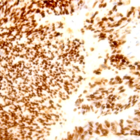 BCL-XL Antibody in Immunohistochemistry (Paraffin) (IHC (P))