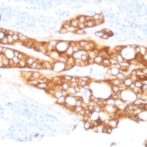 Catenin beta Antibody in Immunohistochemistry (Paraffin) (IHC (P))