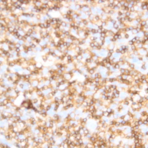 CD122 Antibody in Immunohistochemistry (Paraffin) (IHC (P))