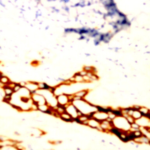 Cytokeratin 6 Antibody in Immunohistochemistry (Paraffin) (IHC (P))
