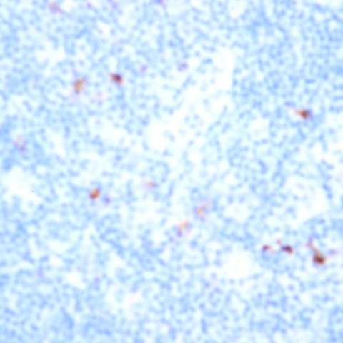 CD49 Antibody in Immunohistochemistry (Paraffin) (IHC (P))