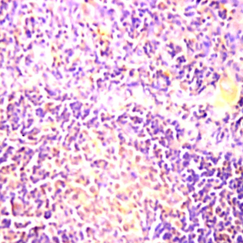CD75 Antibody in Immunohistochemistry (Paraffin) (IHC (P))