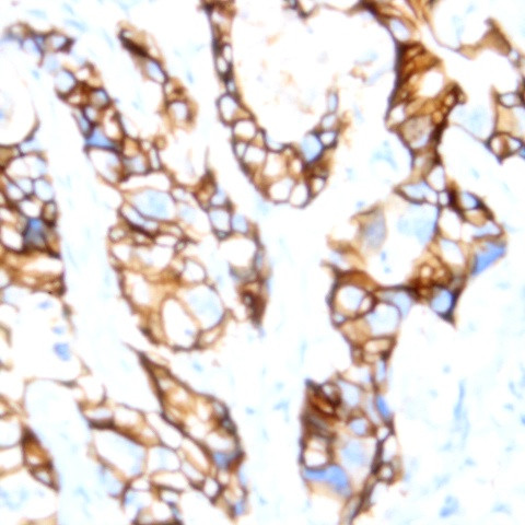 E-Cadherin Antibody in Immunohistochemistry (Paraffin) (IHC (P))
