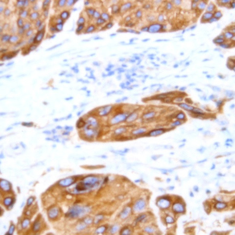 Desmoglein 2 Antibody in Immunohistochemistry (Paraffin) (IHC (P))