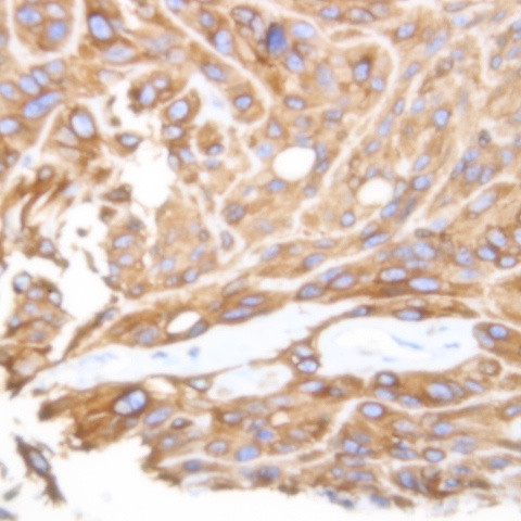 DOG1 Antibody in Immunohistochemistry (Paraffin) (IHC (P))