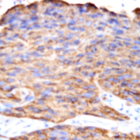 Epha 3 Antibody in Immunohistochemistry (Paraffin) (IHC (P))