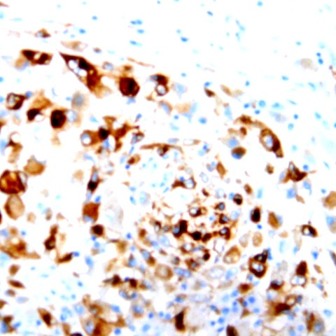 FLI-1 Antibody in Immunohistochemistry (Paraffin) (IHC (P))