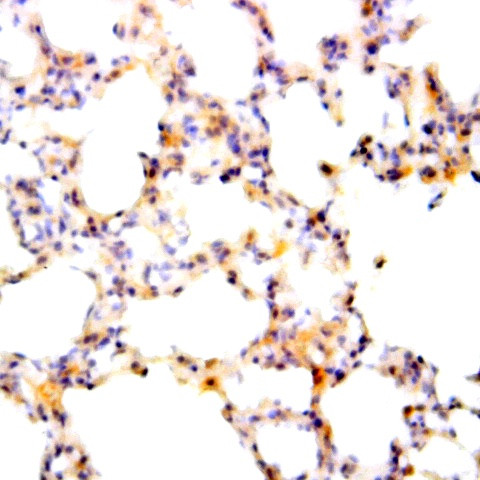INCENP Antibody in Immunohistochemistry (Paraffin) (IHC (P))