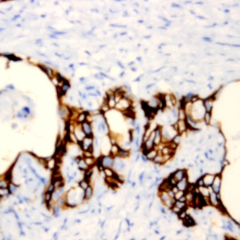 Integrin Beta 1 Antibody in Immunohistochemistry (Paraffin) (IHC (P))