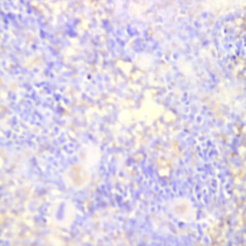 IRS-1 Antibody in Immunohistochemistry (Paraffin) (IHC (P))