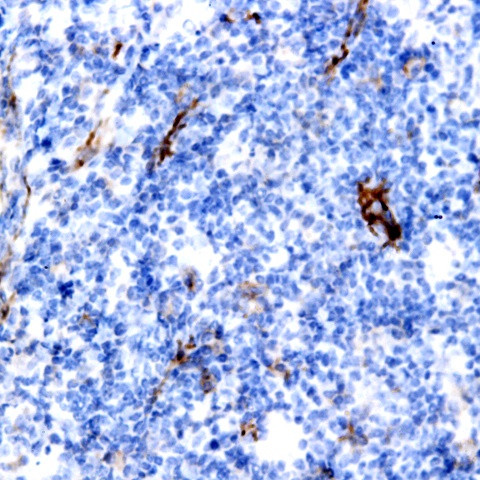 MUC1 (EMA) Antibody in Immunohistochemistry (Paraffin) (IHC (P))