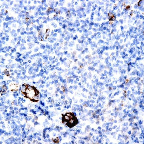 MUC5 Antibody in Immunohistochemistry (Paraffin) (IHC (P))