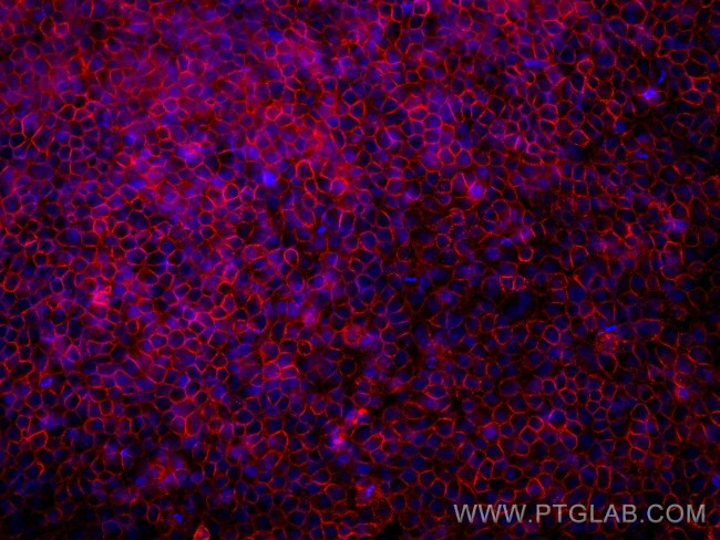 CD47 Antibody in Immunocytochemistry (ICC/IF)