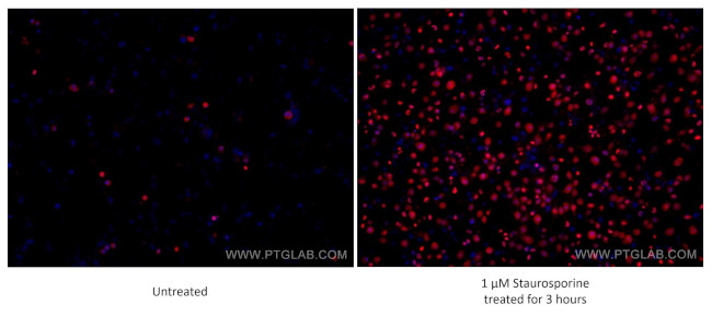 Cleaved PARP1 Antibody in Immunocytochemistry (ICC/IF)