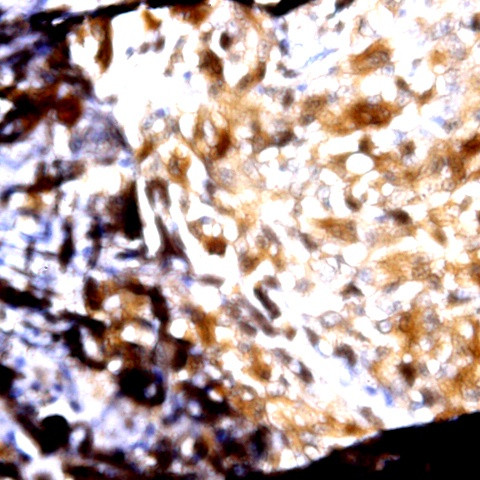 MAdCAM1 Antibody in Immunohistochemistry (Paraffin) (IHC (P))