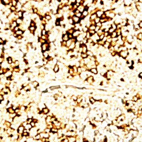 Myeloid Marker Antibody in Immunohistochemistry (Paraffin) (IHC (P))