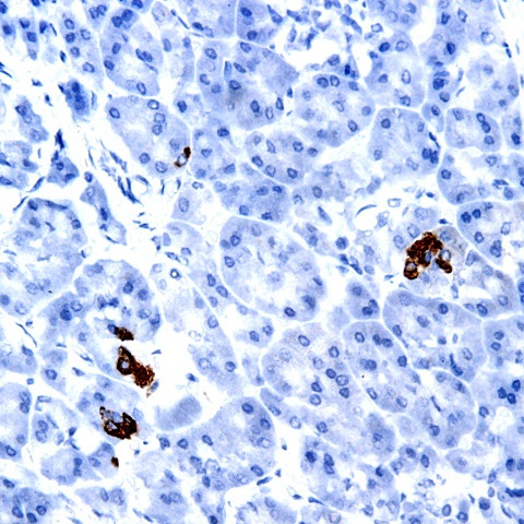 Napsin A Antibody in Immunohistochemistry (Paraffin) (IHC (P))