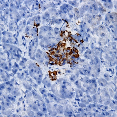 NK-1 Antibody in Immunohistochemistry (Paraffin) (IHC (P))
