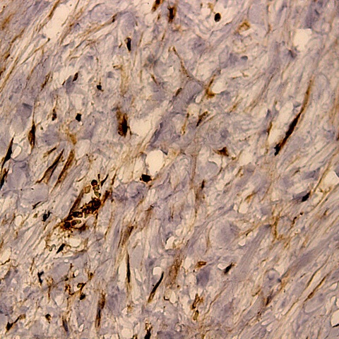 Notch-1 Antibody in Immunohistochemistry (Paraffin) (IHC (P))