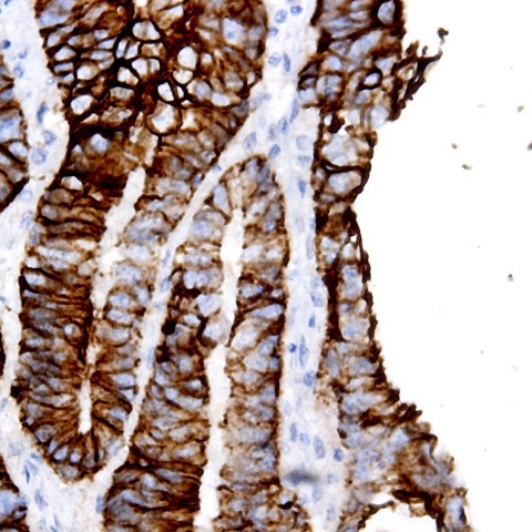 Occludin Antibody in Immunohistochemistry (Paraffin) (IHC (P))