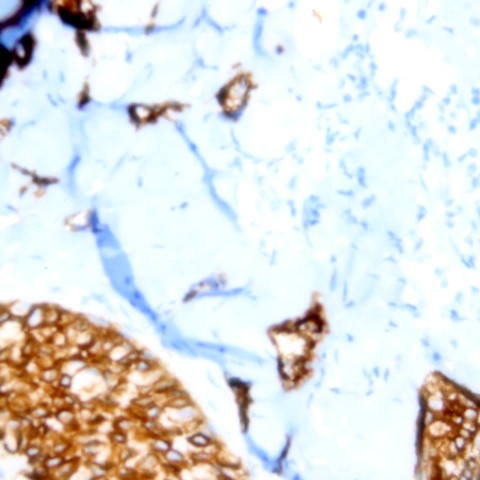 P40 Antibody in Immunohistochemistry (Paraffin) (IHC (P))