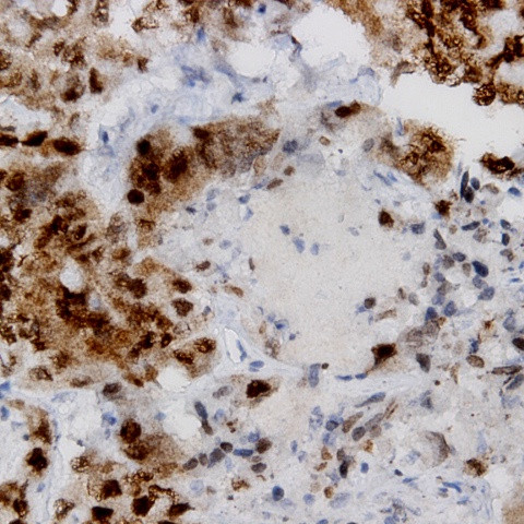 PCNA Antibody in Immunohistochemistry (Paraffin) (IHC (P))