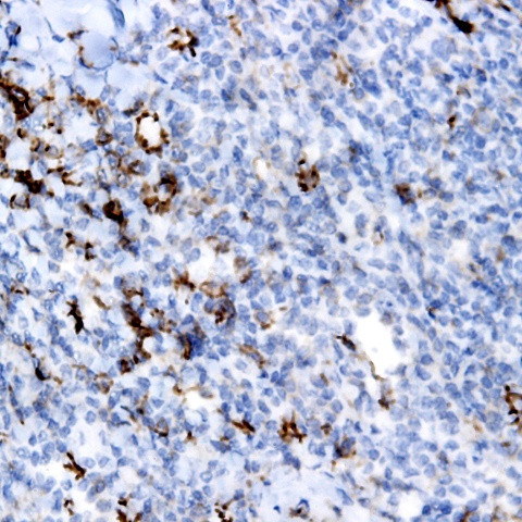 Plasma Cell Marker Antibody in Immunohistochemistry (Paraffin) (IHC (P))