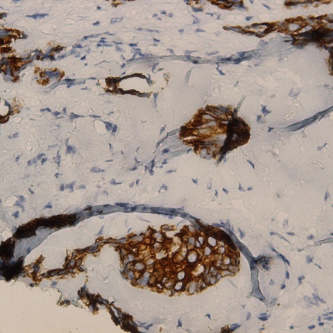 Podocalyxin Antibody in Immunohistochemistry (Paraffin) (IHC (P))