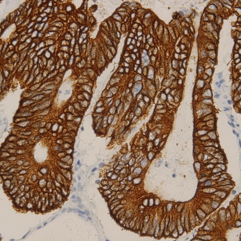 PPP2R5C Antibody in Immunohistochemistry (Paraffin) (IHC (P))