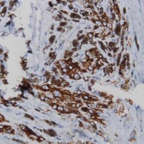 Red Blood Cell Antibody in Immunohistochemistry (Paraffin) (IHC (P))