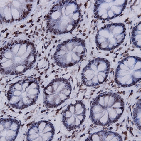 Renal Cell Carcinoma (RCC, gp200) Antibody in Immunohistochemistry (Paraffin) (IHC (P))