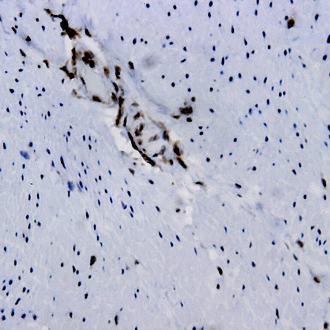 Sgt-1A Antibody in Immunohistochemistry (Paraffin) (IHC (P))