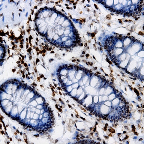 SKP2 Antibody in Immunohistochemistry (Paraffin) (IHC (P))