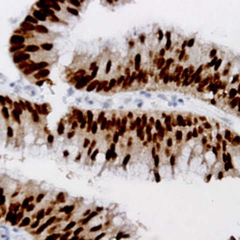 STAT3 Antibody in Immunohistochemistry (Paraffin) (IHC (P))