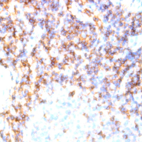 TCR DO11.10 Antibody in Immunohistochemistry (Paraffin) (IHC (P))
