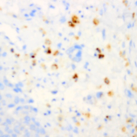 Tenascin C Antibody in Immunohistochemistry (Paraffin) (IHC (P))