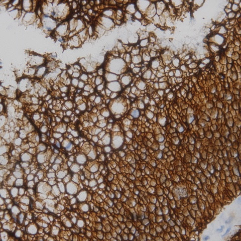 Ubiquitin Antibody in Immunohistochemistry (Paraffin) (IHC (P))