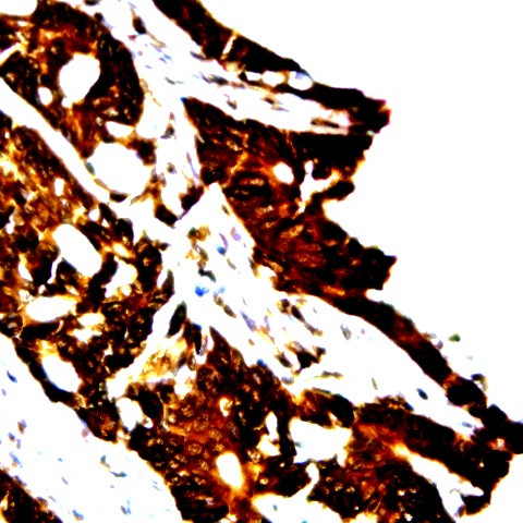Catenin-gamma Antibody in Immunohistochemistry (Paraffin) (IHC (P))