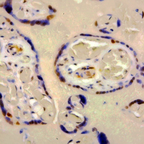 dsDNA (Double strand-DNA) Antibody in Immunohistochemistry (Paraffin) (IHC (P))