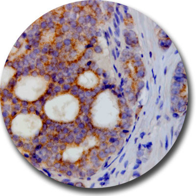 AMACR Antibody in Immunohistochemistry (Paraffin) (IHC (P))