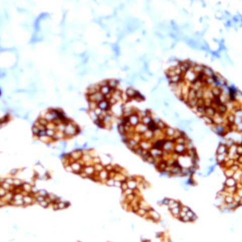 Phospho-Cytokeratin 8 (Ser431) Antibody in Immunohistochemistry (Paraffin) (IHC (P))