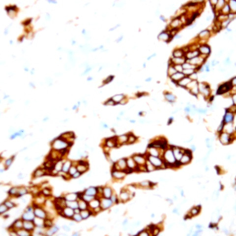 Cytokeratin 10 Antibody in Immunohistochemistry (Paraffin) (IHC (P))